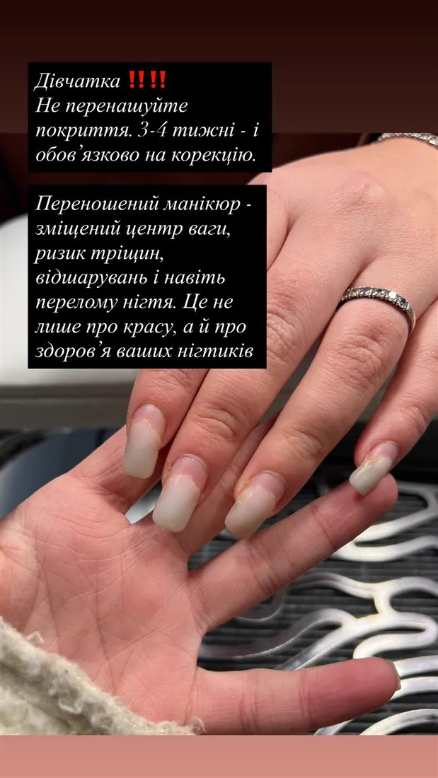 До: довгі нігті зі світлими кінчиками на обох руках.